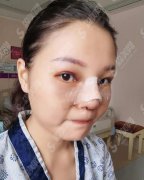 合肥105医院整形价格，2021较新价格表公布，内含鼻部手术术案例果展示