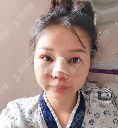 合肥105医院整形价格,2021较新价格表公布,内含鼻部手术术案例果展示