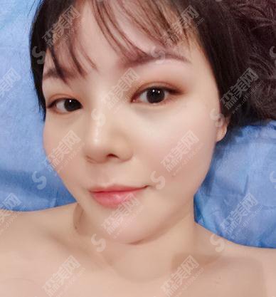 合肥105医院整形价格,2021较新价格表公布,内含鼻部手术术案例果展示