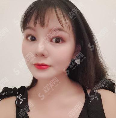 合肥105医院整形价格,2021较新价格表公布,内含鼻部手术术案例果展示