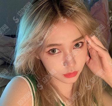 大连医大一院双眼皮做的怎么样呢?2021价目表公布+双眼皮整形案例分享