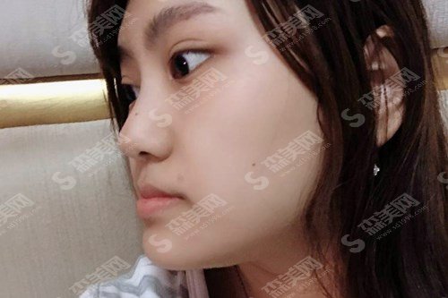 长海医院牙科好吗?长海医院的实力/长海医院的医生/牙齿矫正的果