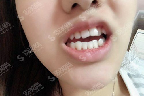 长海医院牙科好吗?长海医院的实力/长海医院的医生/牙齿矫正的果