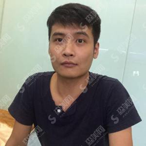 上虞艺美医疗整形医院怎么样？上虞艺美整形的实力/上虞艺美整形的医生/面部黄金微针怎么样