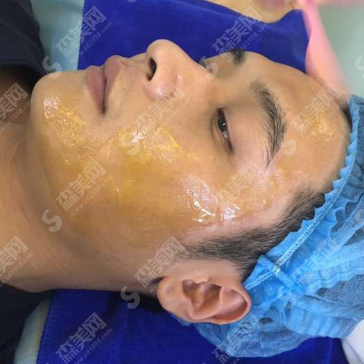 上虞艺美医疗整形医院怎么样？上虞艺美整形的实力/上虞艺美整形的医生/面部黄金微针怎么样