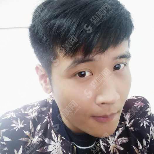 上虞艺美医疗整形医院怎么样？上虞艺美整形的实力/上虞艺美整形的医生/面部黄金微针怎么样