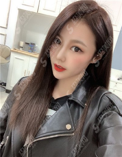 隆鼻整形手术价目表2021,肋软骨隆鼻整形怎么样?肋软骨隆鼻的术后果好不好