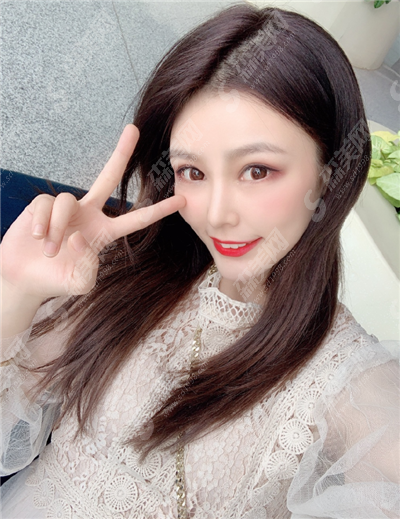 隆鼻整形手术价目表2021,肋软骨隆鼻整形怎么样?肋软骨隆鼻的术后果好不好