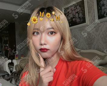 上海第九人民医院整形科价格表一览,内含面部埋线提升术后恢复反馈