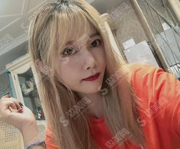 上海第九人民医院整形科价格表一览,内含面部埋线提升术后恢复反馈