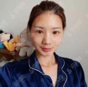 上海靠谱的整形美容医院有哪些？上海华美价格表如何，内含面部填充案例