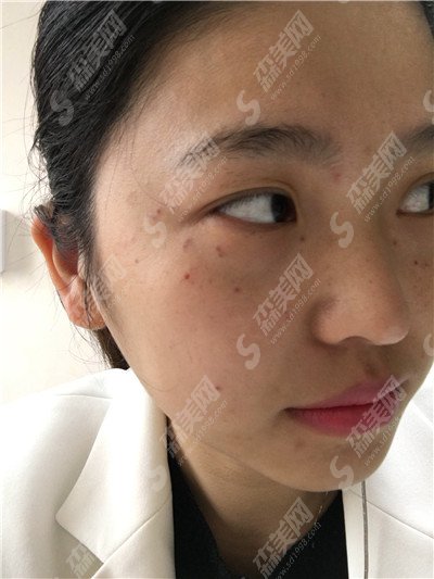 商丘华美整形医院怎么样?医院的实力概况/医生的力量/激光祛斑的果