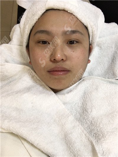 商丘华美整形医院怎么样?医院的实力概况/医生的力量/激光祛斑的果