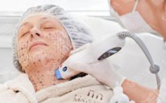 热玛吉多少钱？热玛吉的果怎么样？附热玛吉持续时间以及热玛吉案例分享