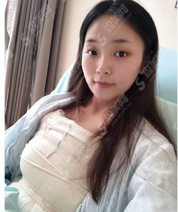 丰胸价格一览表2021,内含上海九院隆胸案例分享及术后注意事项