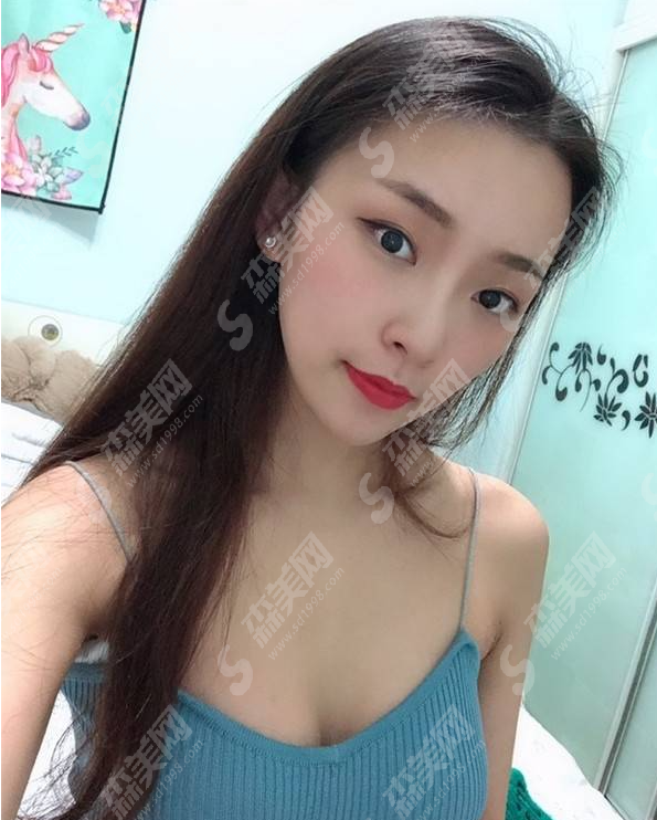 丰胸价格一览表2021,内含上海九院隆胸案例分享及术后注意事项