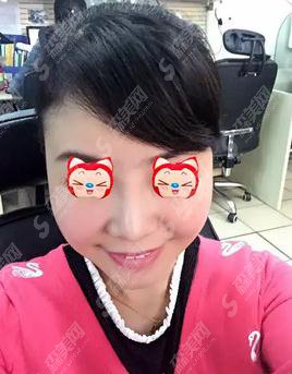 杭州浙一打水光补水价格,2021价格表公布,内含水光补水案例恢复一览