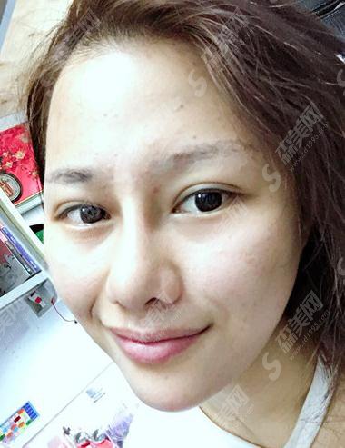 痘博士价目表2021,内含水光补水治疗果对比分析