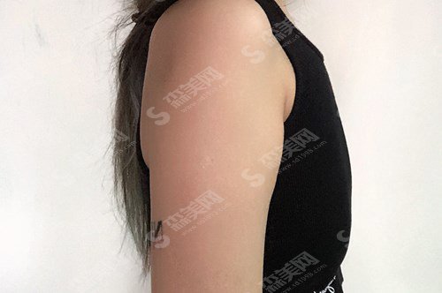 郑州集美整形医院怎么样?郑州集美整形实力/郑州集美的医生一览/隆胸的整形果