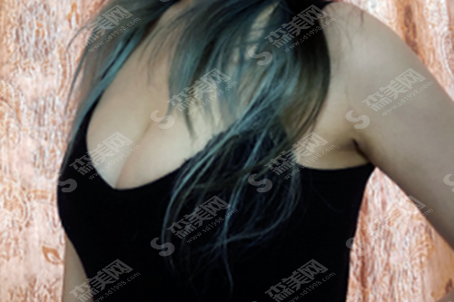 郑州集美整形医院怎么样?郑州集美整形实力/郑州集美的医生一览/隆胸的整形果