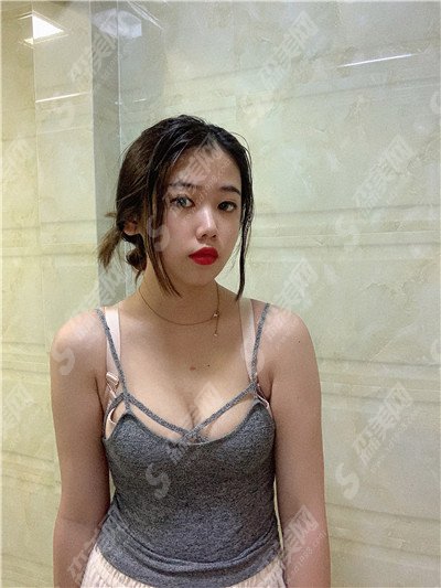 西安口碑较好医院有哪些?医院概况/医生实力/隆胸果