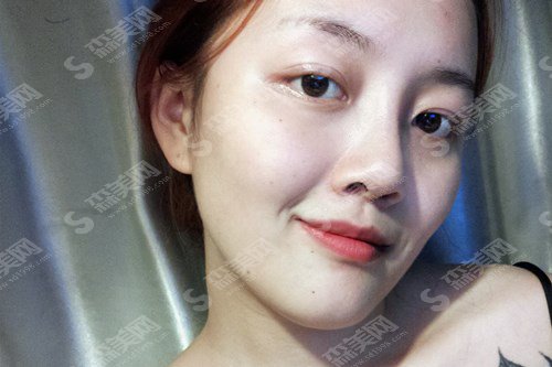 成都华西医院整形科哪个医生好?整形医生一览/双眼皮的价格表