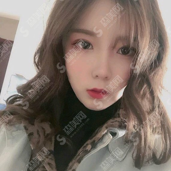 上海港华医院怎么样？上海港华医院的实力/医生实力/下颌角整形的果