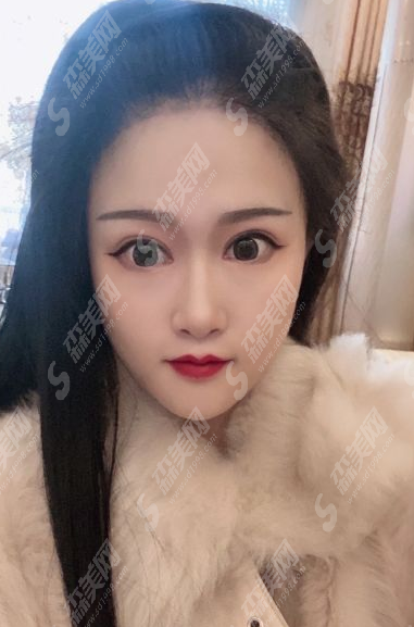 成都雍禾植发医院的植发果怎么样?附案例分享/医院简介/价目表2021