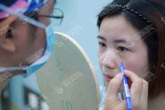 东莞同济光华医院价目表2021，内含鼻部手术术后恢复对比图