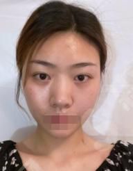 深圳禾丽整形医院做的整形果如何？附医师介绍及案例分享