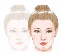 玻尿酸隆下巴的优势是什么?附玻尿酸隆下巴的术后护理及玻尿酸价格一览表2021