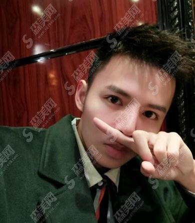 重庆铜雀台价目表2021，内含膨体隆鼻恢复期的图片