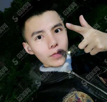 重庆铜雀台价目表2021，内含膨体隆鼻恢复期的图片