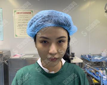 西京医院做双眼皮价格表2021,附案例真实反馈详情