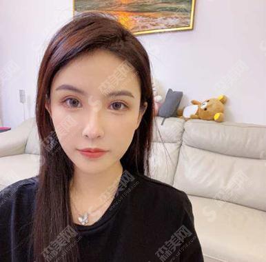 西京医院做双眼皮价格表2021,附案例真实反馈详情