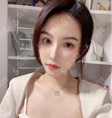 西京医院做双眼皮价格表2021,附案例真实反馈详情