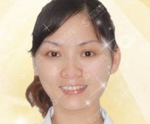 整形医生林亚红皮肤诊疗专业吗？华仁整形美容医院/口碑见解/案例展示