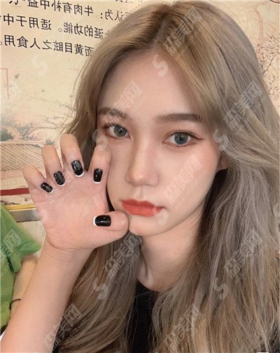 双眼皮的整形价目表2021版一览&内附张峰医生的双眼皮案例果恢复图