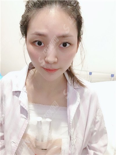 深圳北大的整形价目表2021,隆胸怎么样?内附较新隆胸价目表