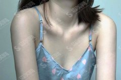 美莱整形丰胸价目表2021,丰胸怎么样？内附较新丰胸价目表