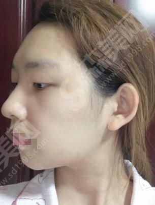 上海美伦整形整形医院怎么样？上海美伦整形整形医院做的整形果如何？附医师介绍及案例分享