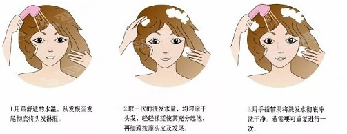 额角植发果怎么样?附案例分享/术后注意事项/恢复果/较新价格一览表