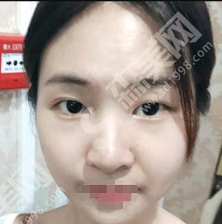 苏州美莱整形医院做的整形果如何？附医师介绍及案例分享