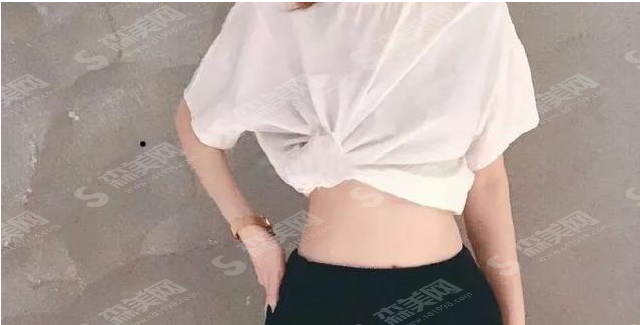 长沙三和整形医生做的腰腹吸脂果好吗？附案例分享/医生简介/吸脂较新价格表