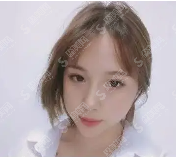 自体脂肪面部填充的果怎么样?附案例分享及整形较新价目表