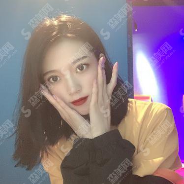 马满仓双眼皮整形手术做的可以吗?美诗沁医院/个人简介/眼部案例