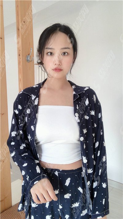 河南中医药大学第一附属医院整形价目表2021,假体隆胸好不好？内附较新的隆胸价目表