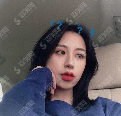 上海容妍整形医院价目表2021,内含假体隆鼻术后详情对比图浏览