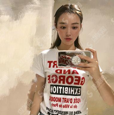 上海ido整形医院价目表2021,内含种植发际线术后果展示