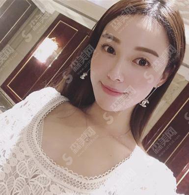 上海ido整形医院价目表2021,内含种植发际线术后果展示